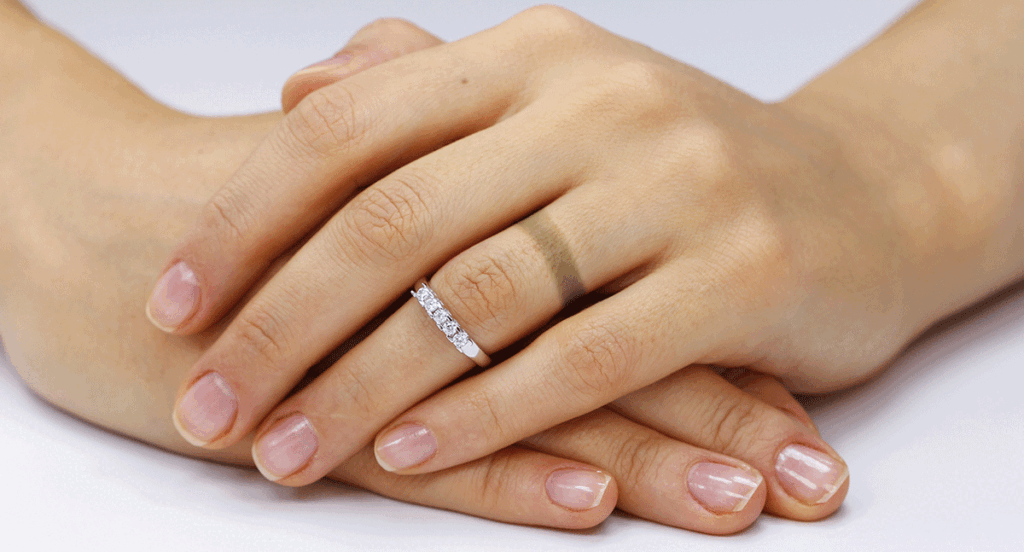 Skin discoloration from wearing a ring
